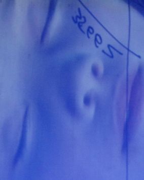 Gottfried Helnwein and the Dreaming Child