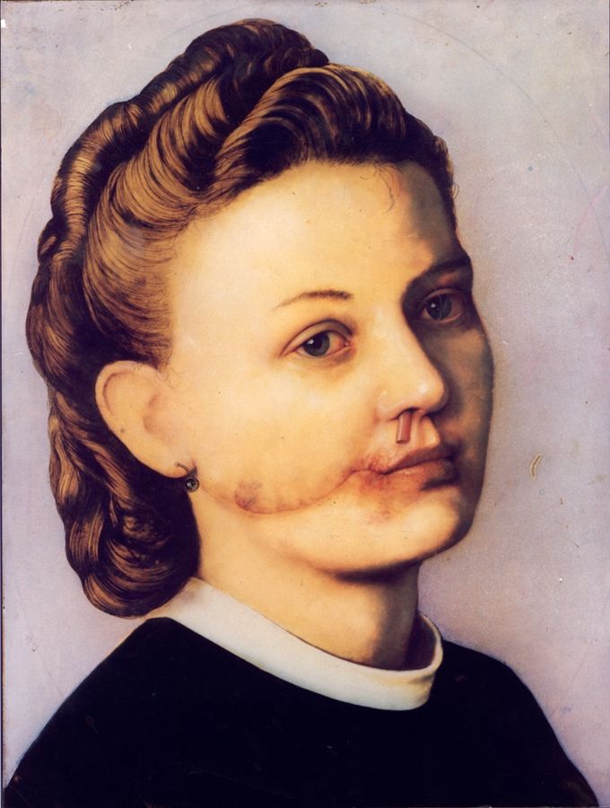 Gottfried Helnwein: Mutter - Du hier?
